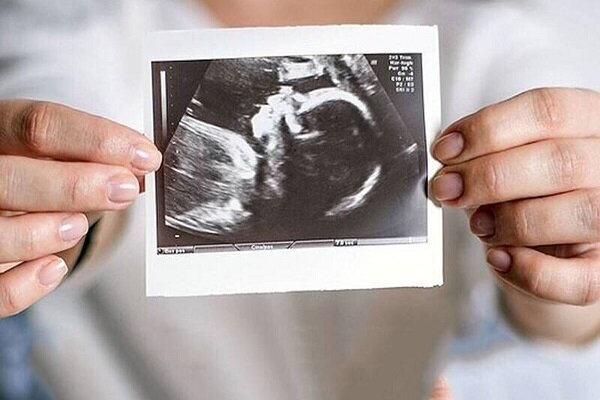 یک روز همراه با زوجهای نابارور در بیمارستان بنتالهدی؛ در آرزوی فرزند